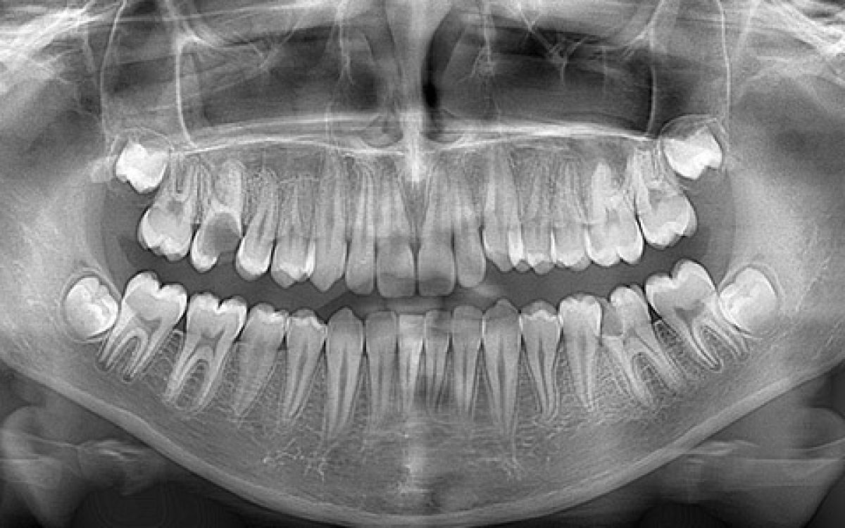 Oral-Diagnoz-ve-Radyoloji